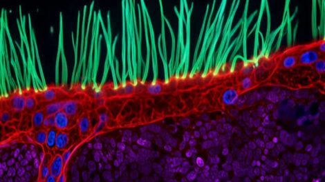 Nikon Small World Competition