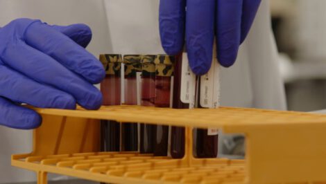 Galleri test samples being prepared for processing in a Grail lab. Grail Inc.